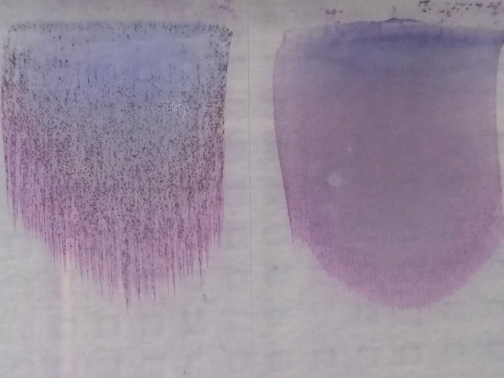Cold agglutinin disease - macroscopic agglutination on blood smear